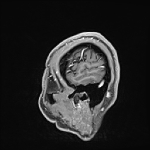 Click on the Serie image to view the images of VILLANUEVA, WILLIAM A.